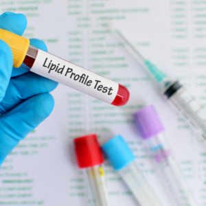 Lipid Profile