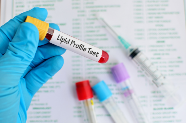 Lipid Profile